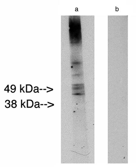 "
Western blot analysis using LAG1 longevity assurance homolog 2 (Cat. # X2307P) at 10ug/ml on human placenta lysate (Cat. # X1635C) 14 ug/lane.  Lane A] antibody alone, Lane B] conjugate alone. Visualized using Pierce West Femto substrate system.  Anti Rabbit secondary used at 1:10K dilution (Cat. # X1207M).  Exposure for 5 minutes"